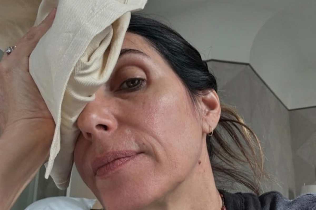 Giorgia cosa ha fatto sul volto